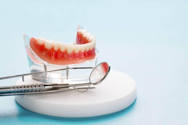 Full Mouth Reconstruction in Hannibal, MO